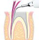 Endodontics/E5 -varios